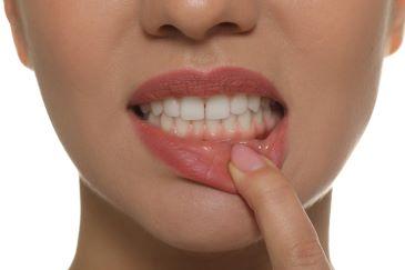 Woman holding her lip down with gum disease, Lindenhurst NY