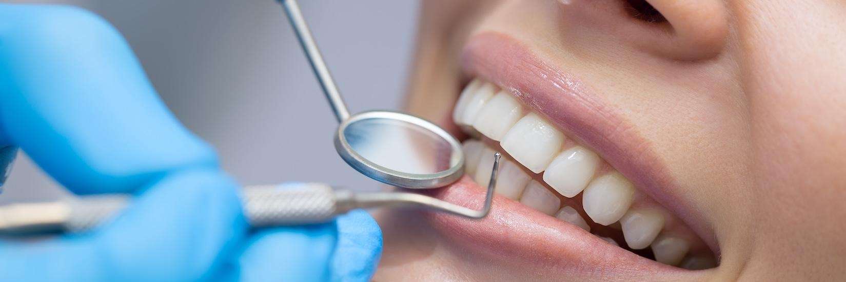 Close up of womans smile before a teeth whitening, lindenhurst ny