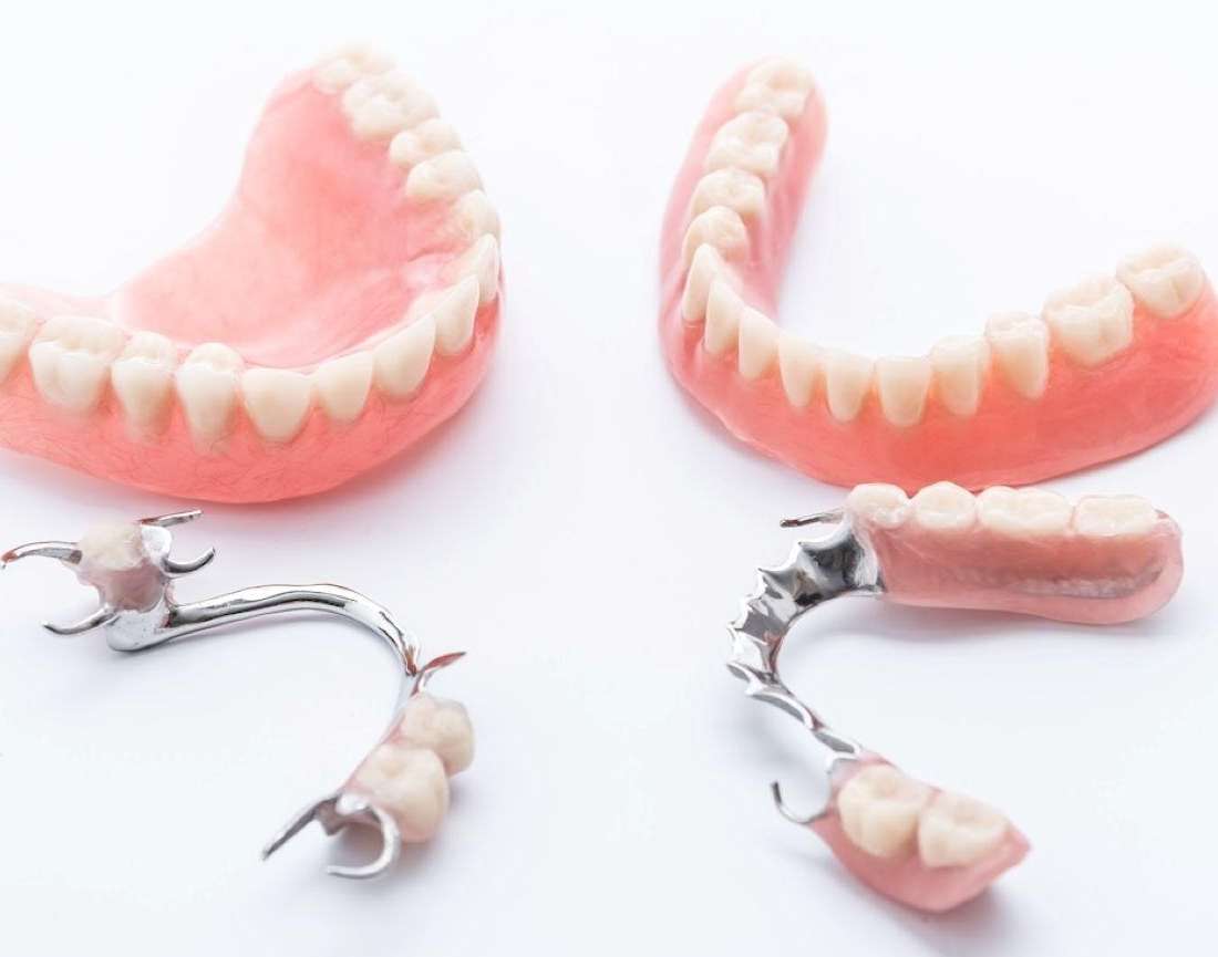 Dentures vs. Partials: Which Is Right for You? | Lindenhurst NY
