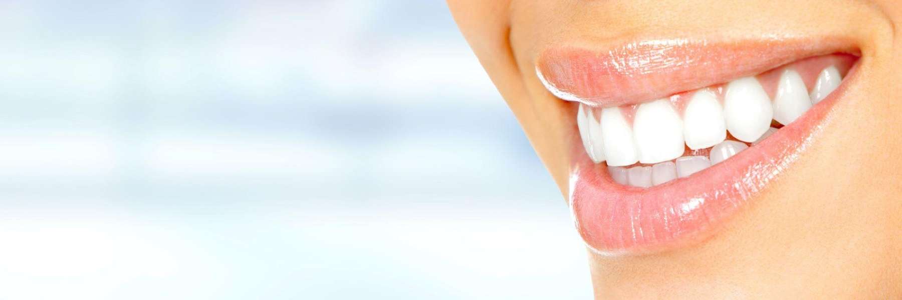 Woman's smile after getting composite bonding, Lindenhurst NY